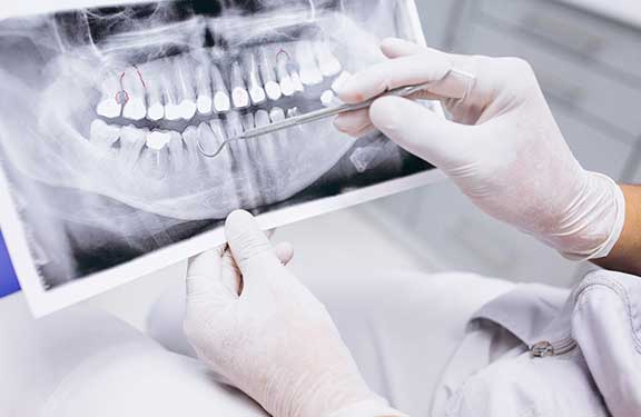 Principales tratamientos odontológicos y su costo aproximado